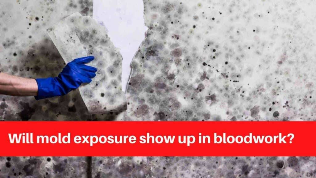 Will mold exposure show up in bloodwork